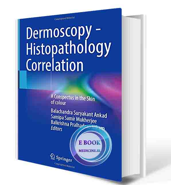 دانلود کتاب Dermoscopy - Histopathology Correlation: A Conspectus in the Skin of colour 1st ed. 2021  (ORIGINAL PDF) (2)